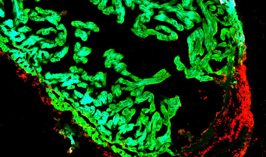Bright green image of regenerated heart tissue