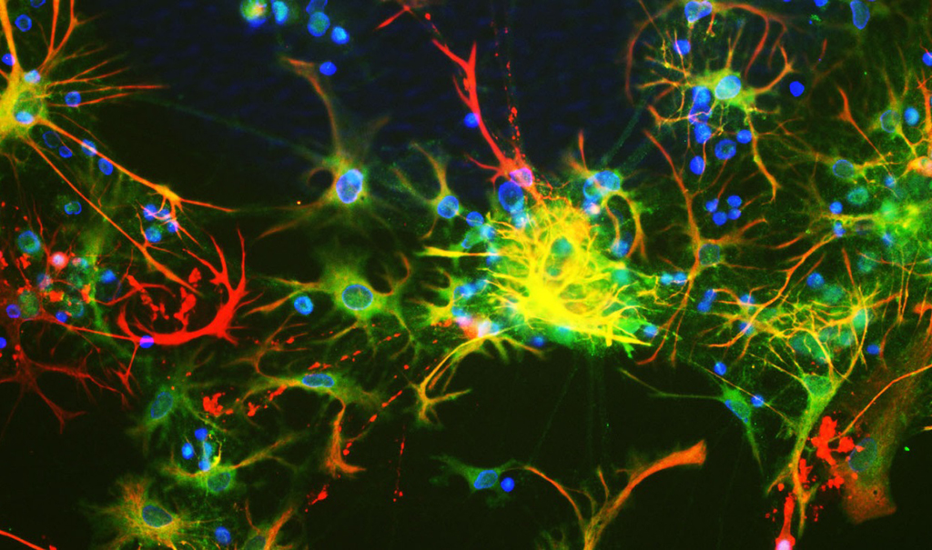Image of brain neurons